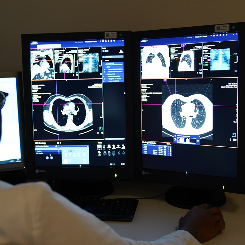 Scanner - Tomodensitométrie - CT Scan | HUmani