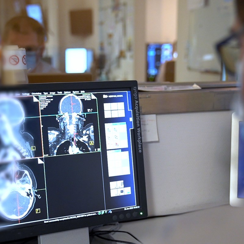 Scanner - Tomodensitométrie - CT Scan | HUmani